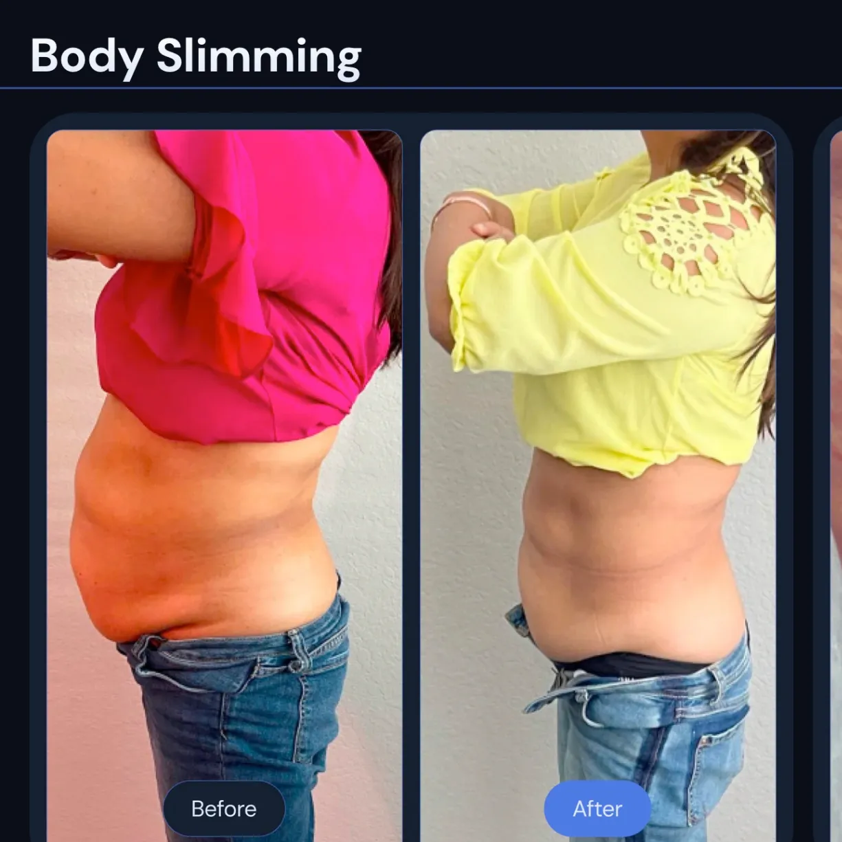 infraSCULPT of Oklahoma gallery photo 1